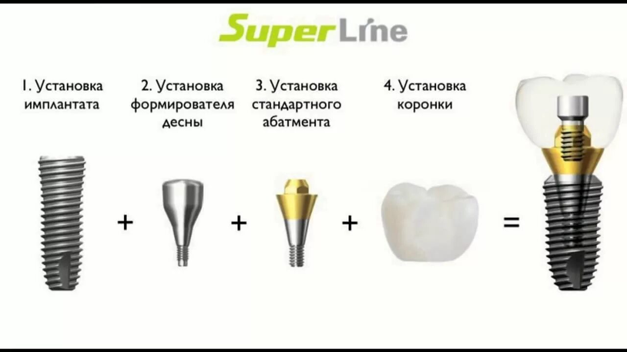 Имплант лайн. Имплантация Dentium Superline. Имплант Implantium Superline. Корейский имплант Dentium. Имплантаты Dentium Implantium.