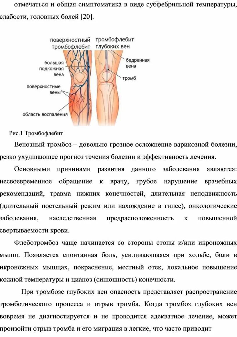 Тромбофлебит бедренной вены. Тромбофлебит сосудов бедра. Карта вызова СМП варикозное расширение вен нижних конечностей. Варикозное заболевание вен нижних конечностей. Тромбоз определение