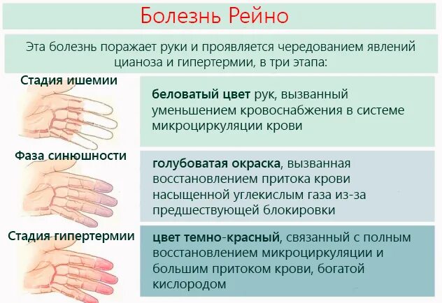 Основные клинические симптомы при синдроме Рейно. Ангиоспастический синдром Рейно. Синдром Рейно дротаверин.