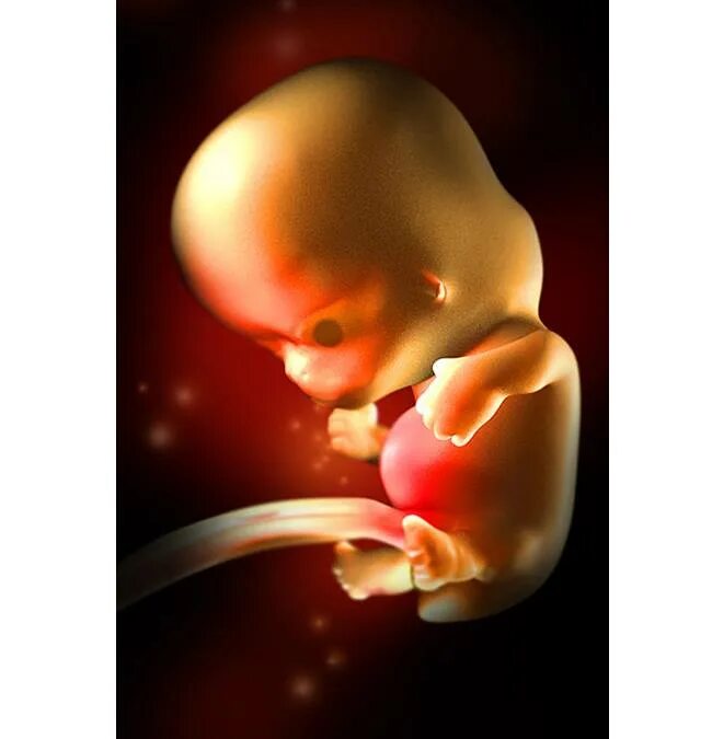 Как выглядит эмбрион в 20 недель. Плод в жизни в 20 недель. Как выглядит двадцати недельный ребенок. Настоящий плод на 20 неделе беременности видео. 8 неделя 24 года
