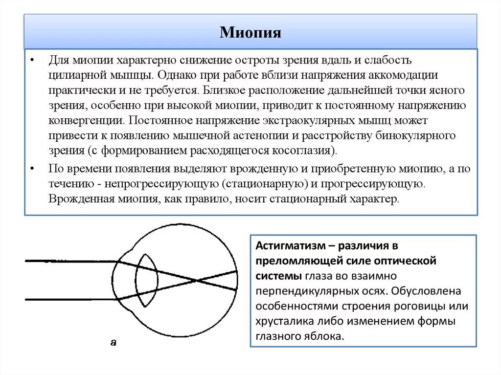 Миопия. Диагноз миопия. стационарная близорукость.