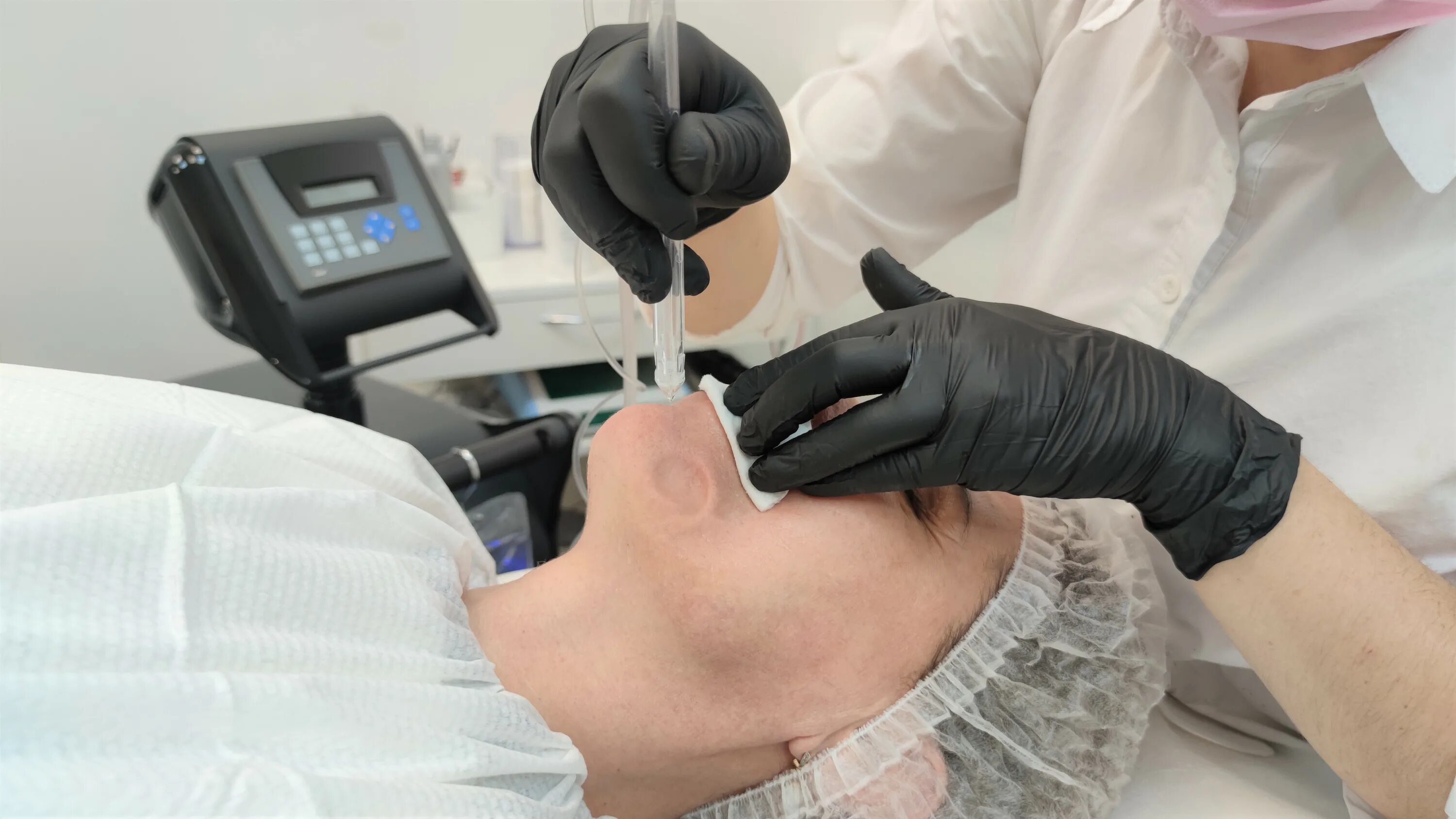 Джет пит процедура. Газожидкостный пилинг jet peel. джет пил jet peel процедура.