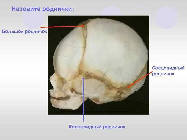 Когда заживает родничок. Клиновидный и сосцевидный роднички. Сосцевидный Родничок черепа. Клиновидный Родничок строение. Клиновидный Родничок черепа.