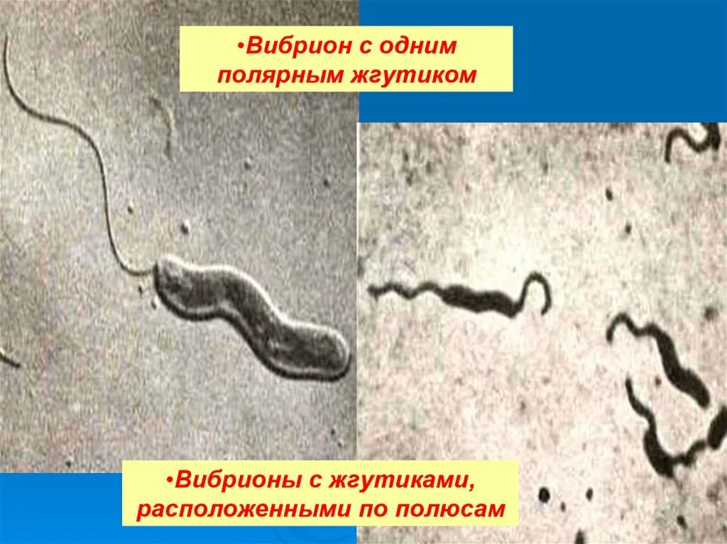 Организм трутовик окаймленный холерный вибрион. Вибрионы жгутики. Вибрион факультативный паразит. Вибрионы фото. Вибрион располагается.