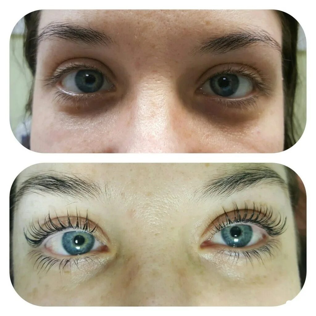 валики кати виноградовой. наращивание ресниц классика 2д 3д 4д 5д. ресницы торчат из под нарощенных. почему ресницы не получаются. испорченные ресницы после ламинирования.