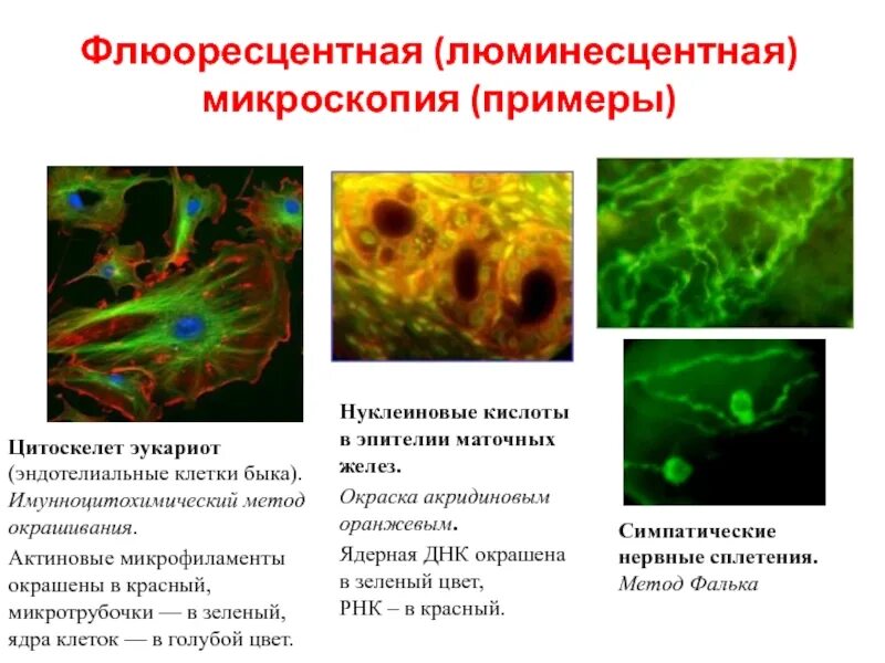 Цитоскелет клетки флуоресцентная микроскопия. Цитоскелет микрофиламенты. Люминесцентная микроскопия микробиология. Цитоскелет актиновые микрофиламенты. Называют обладают флюоресцируют