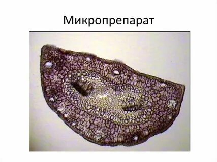 Хвоинка под микроскопом