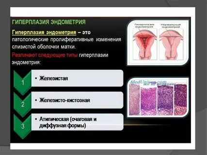 Гиперплазия матки форум отзывы