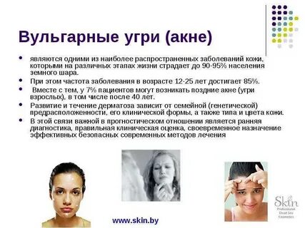 Серобея