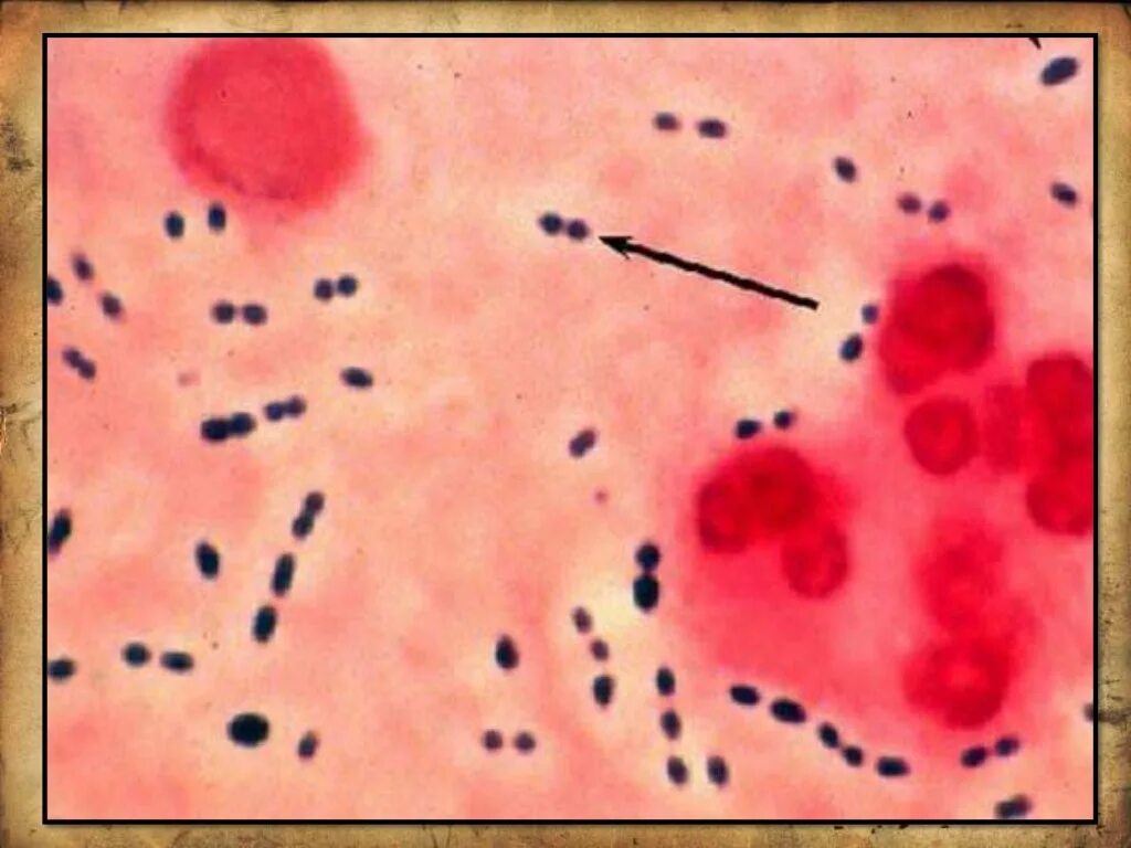 Энтерококки faecalis. Энтерококк фекальный микроскопия. Enterococcus faecium стрептококки. Энтерококк фэциум.