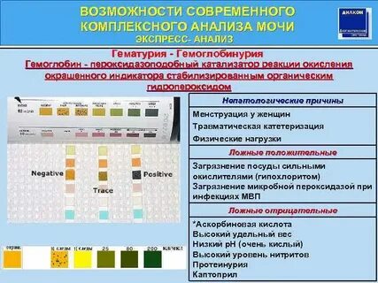 Экспресс моча