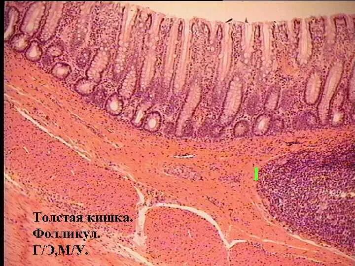 Ткани толстой кишки. Препарат толстой кишки гистология. Препарат Толстого кишечника гистология. Толстая кишка гистология препарат. Толстый кишечник гистология препарат.
