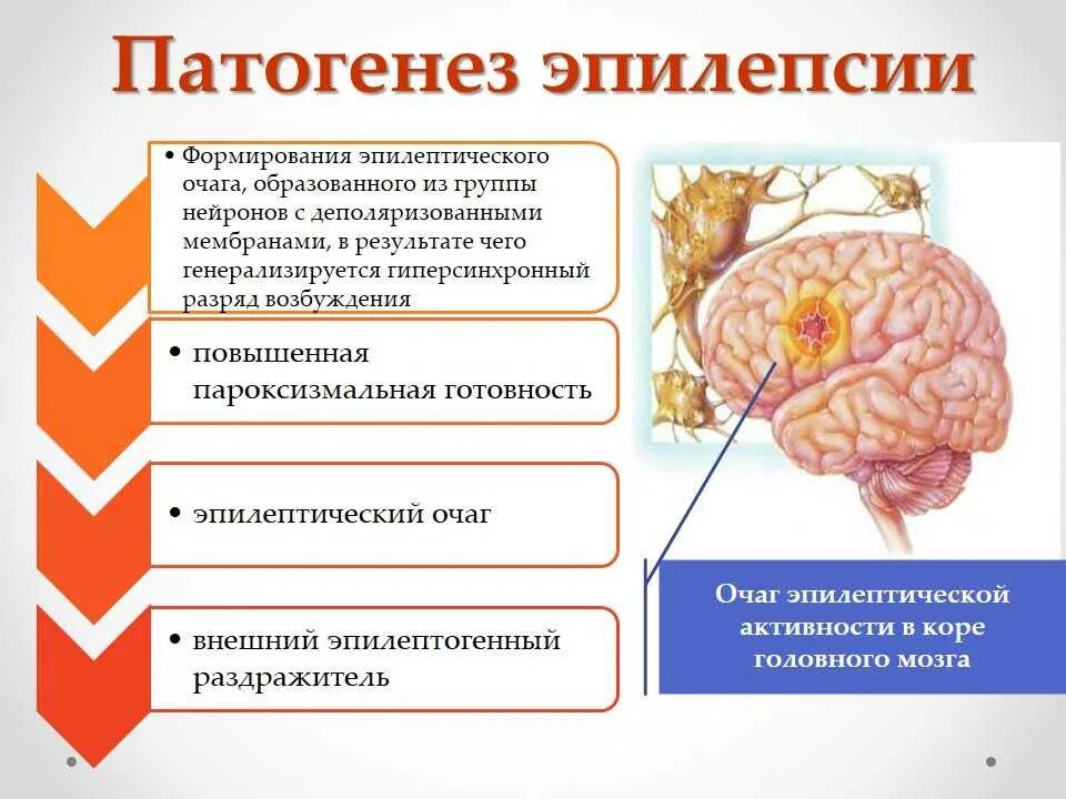 Поражение это простыми словами. Патогенез эпилептического приступа. Эпилепсия патогенез причины. Этиология причины эпилепсии. Очаг поражения головного мозга при эпилепсии.