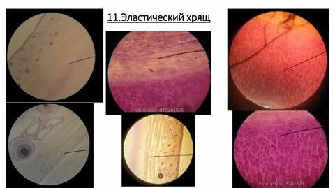 Эластический хрящ