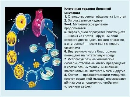 Клетка терапия