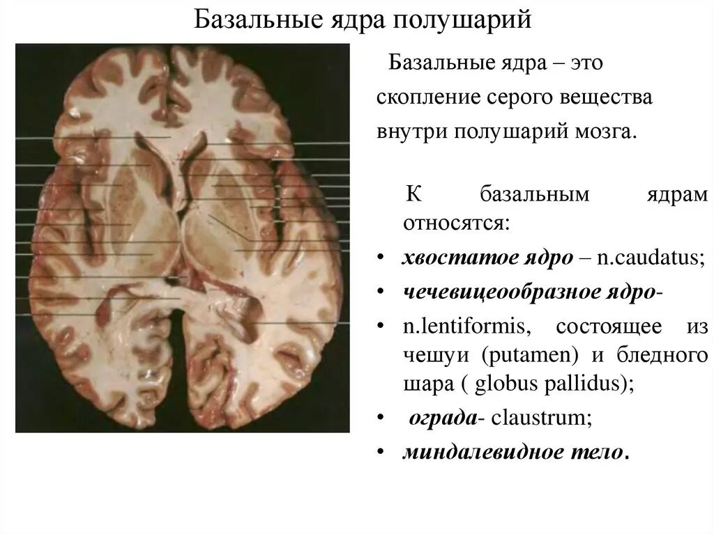 Базальные ядра больших полушарий мозга. Базальные ядра головного мозга анатомия. Базальные ядра и белое вещество полушарий большого мозга. Базальные ядра конечного мозга таблица. Изменение в базальных отделах