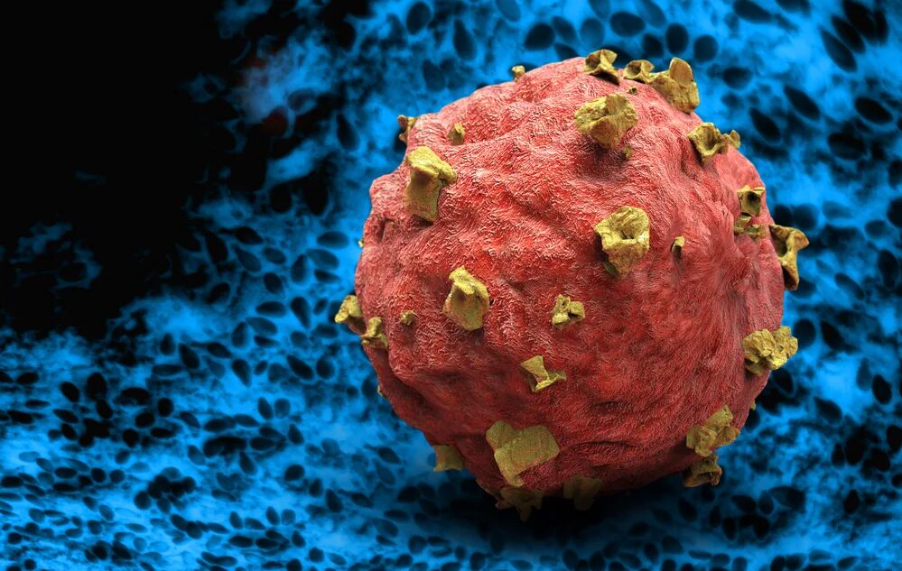 Онкологические клетки. Злокачественные клетки. Раковые клетки под микроскопом. Питание раковой клетки