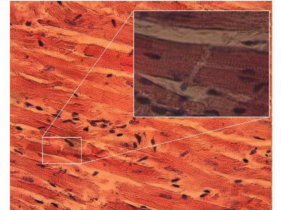 Сердечная ткань миокарда. Кардиомиоциты под микроскопом. сердечная мышечная ткань миокард. мышечная ткань под микроскопом. повреждение кардиомиоцитов под микроскопом.