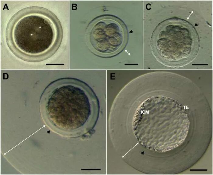 Эмбрион после пересадки. Эмбрион бластоциста. Протокол культивирования эмбрионов. Бластоциста подсадка.