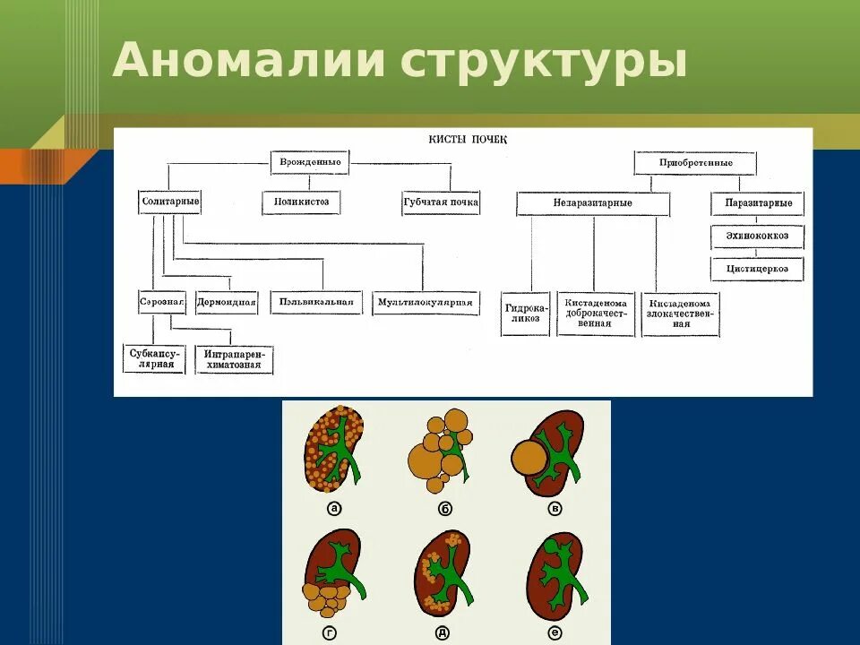 Классификация видов почек по строению. Аномалии структуры. структурные аномалии почек. аномалии и пороки структуры почки. аномалии развития почек классификация.
