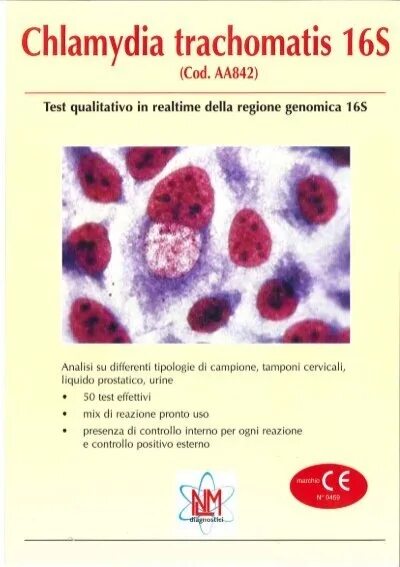 Chlamydia trachomatis. Хламидия трахоматис возбудитель. Язвы, вызванные хламидией трахоматис. Хламидия трахоматис 2,08.