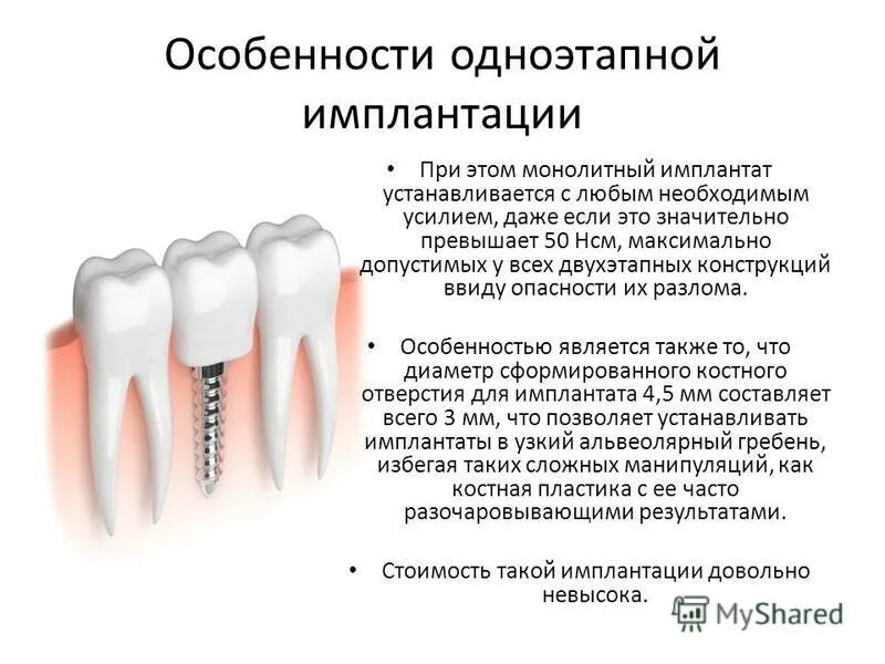 Двухэтапная методика имплантации. Методики дентальной имплантации. Имплант зуба схема установки. Одноэтапный протокол: имплантация.