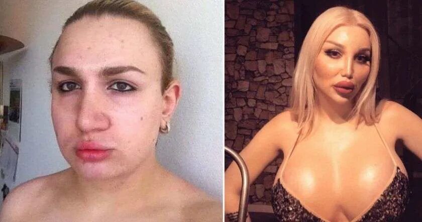 Man transformation women. Перевоплощение в женщину. Пластические операции трансгендерам. Девушки с пластическими операциями.