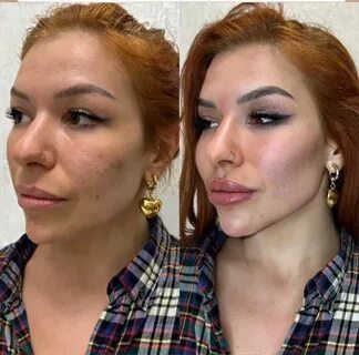 Фейс фулл отзывы