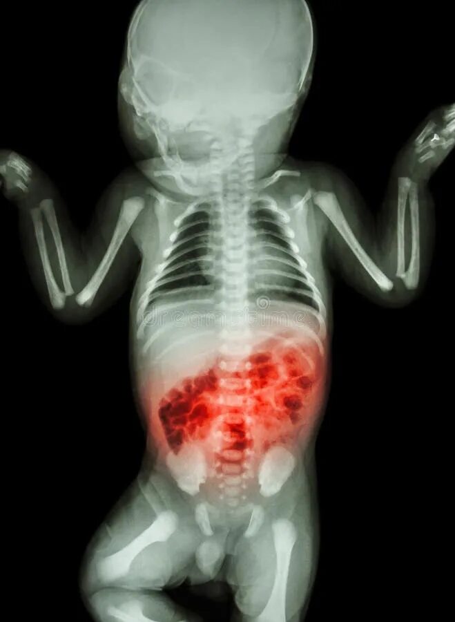 COPD Natural Treatments - Jeffrey Dach MD Chronic obstructive pulmonary disease,