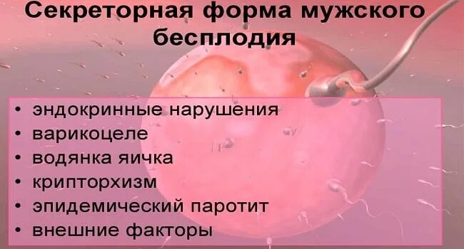 Формы мужского бесплодия. Причины мужского бесплодия. Секреторное бесплодие. Причина секреторной формы мужского бесплодия. Бесплодие у мужчин после