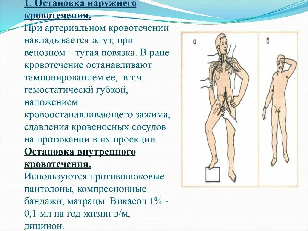 Остановка кровотечения в паховой области. Остановка артериального кровотечения в паховой области. Тампонаж для остановки артериального кровотечения. Остановка кровотечения из паховой артерии.