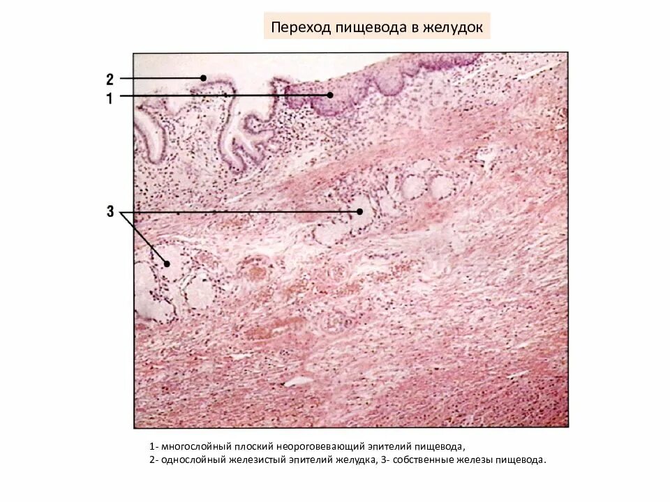 Какие железы в пищеводе. Железистый эпителий желудка гистология. Переход пищевода в желудок препарат гистология. Пищевод гистология препарат. Гистологисрез пищевода гистология.