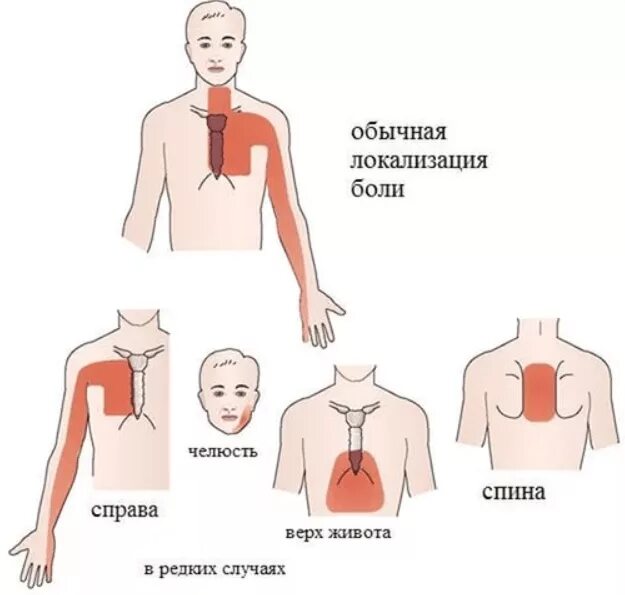 8 signálov, ktoré vám telo zahlási pred blížiacim infarktom. Neignorujte ich Chi