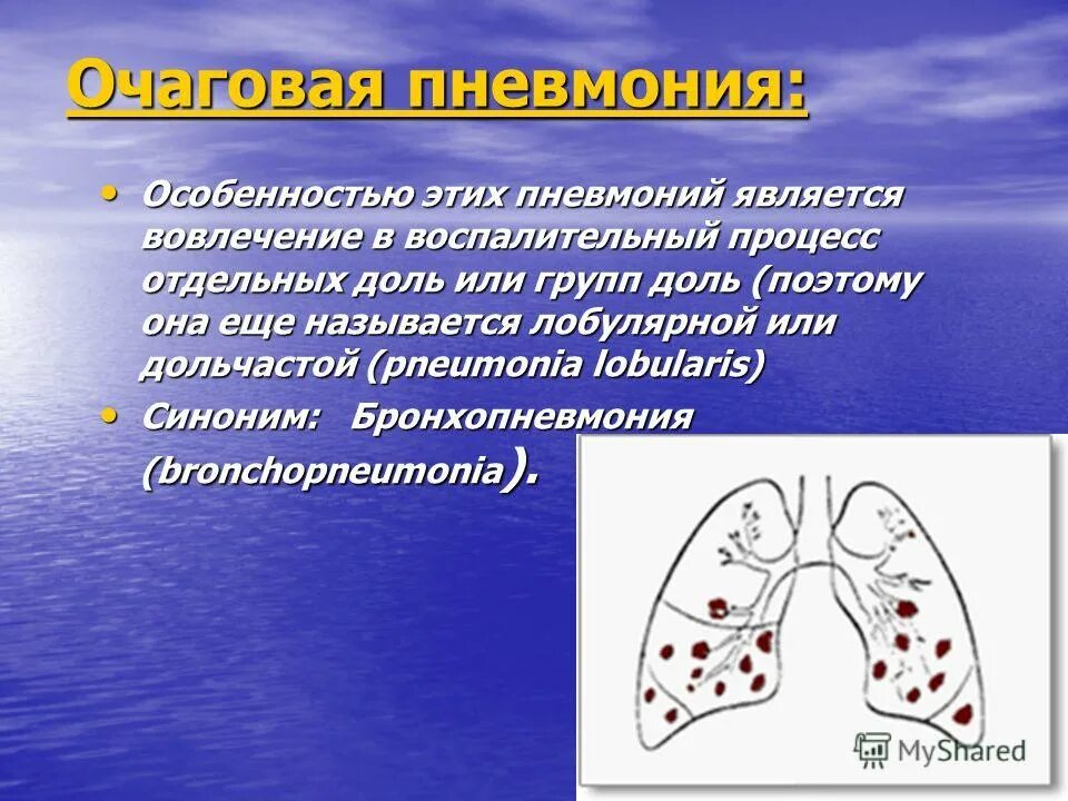 Почему уменьшается легкое. Осложнения очаговой пневмонии. Осложнения острой очаговой пневмонии. Презентация на тему очаговая пневмония.