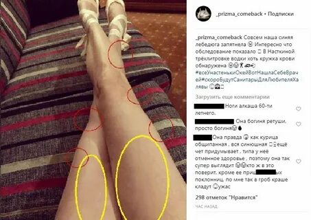 Ноги алкоголизм