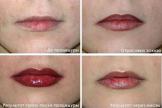 Сколько времени заживает губа. Перманент губ этапы заживления. Губы после перманентного макияжа. Перманентный макияж губ до и после. Татуаж ассиметричных губ.