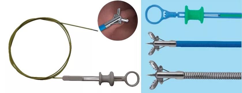 протокол гастроскопии. биопсия желудка по olga. фгдс с биопсией по olga. биопсия фгдс расшифровка. точки биоптата желудка.