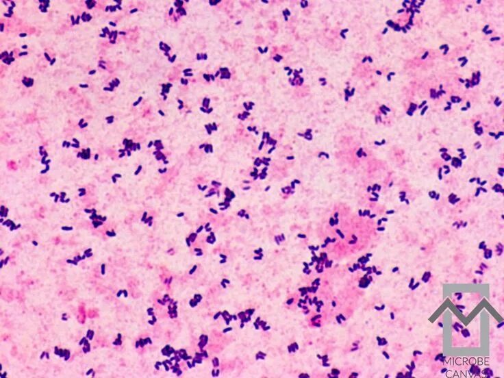 Corynebacterium spp в мазке у мужчин