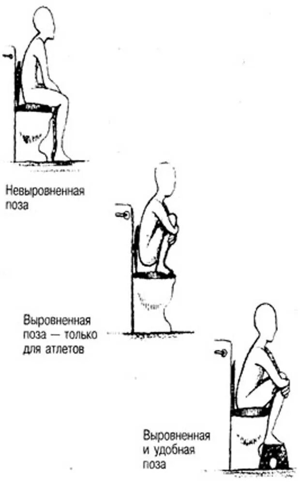 Дефекация при запоре. Правильная поза для опорожнения. Правильная поза при запоре. Правильная поза для туалета. Удобные позы для хождения в туалет.