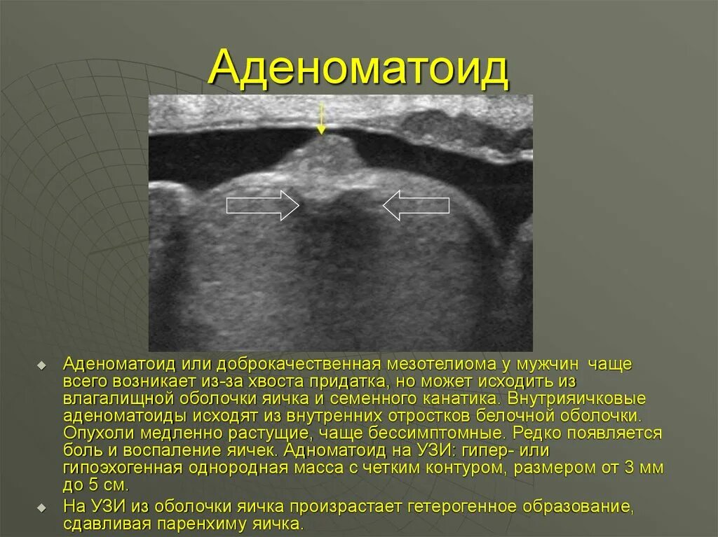 Редко появляется