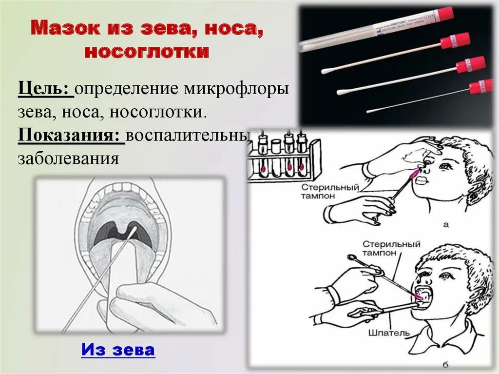 Посев полости рта. Алгоритм взятия мазков из носа и зева на ПЦР. Лабораторная посуда для взятия мазка из зева и носа. Алгоритм взятия мазка зева. Техника взятия мазка из зева и носа на микрофлору.