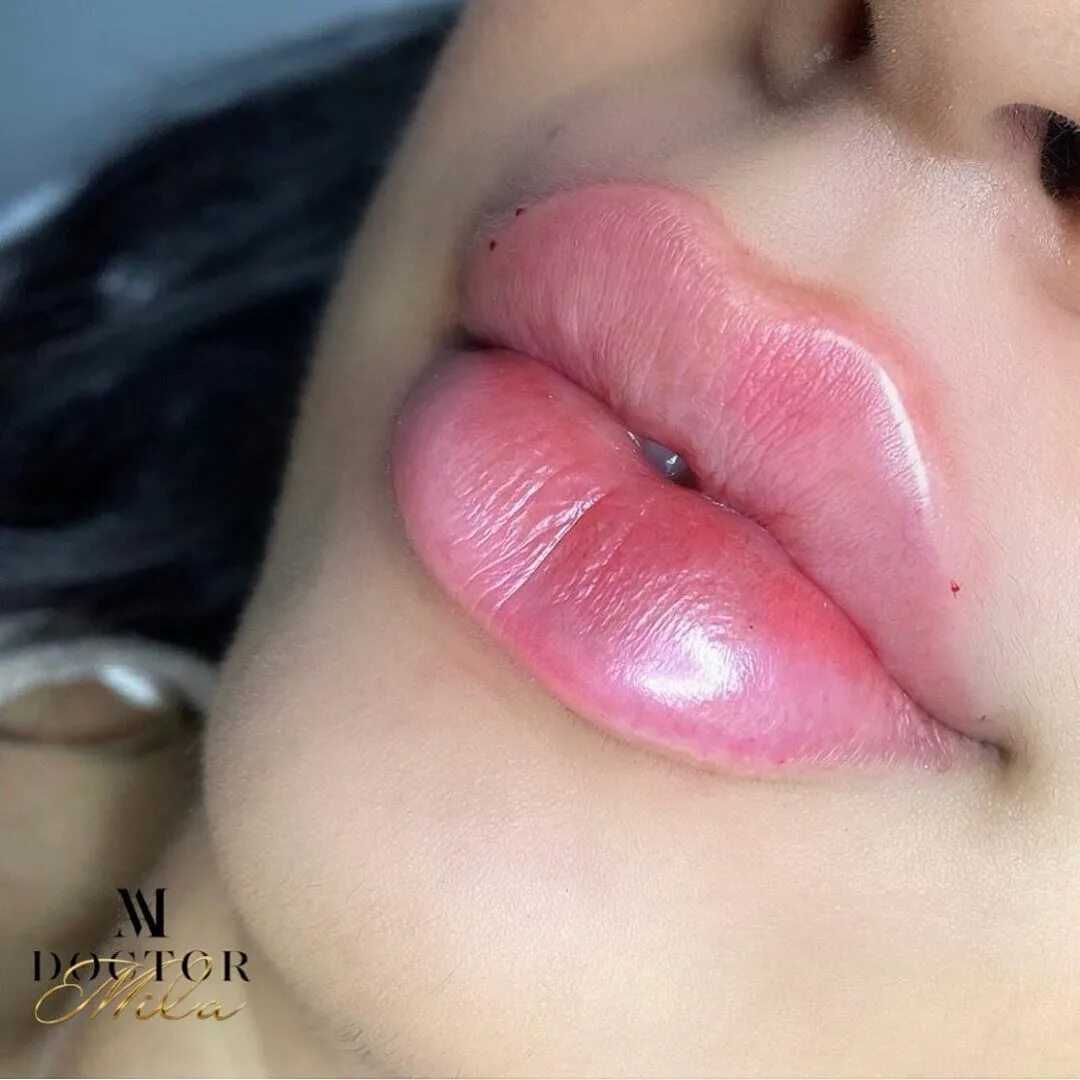 Форма губ бант. Форма губ бантиком.