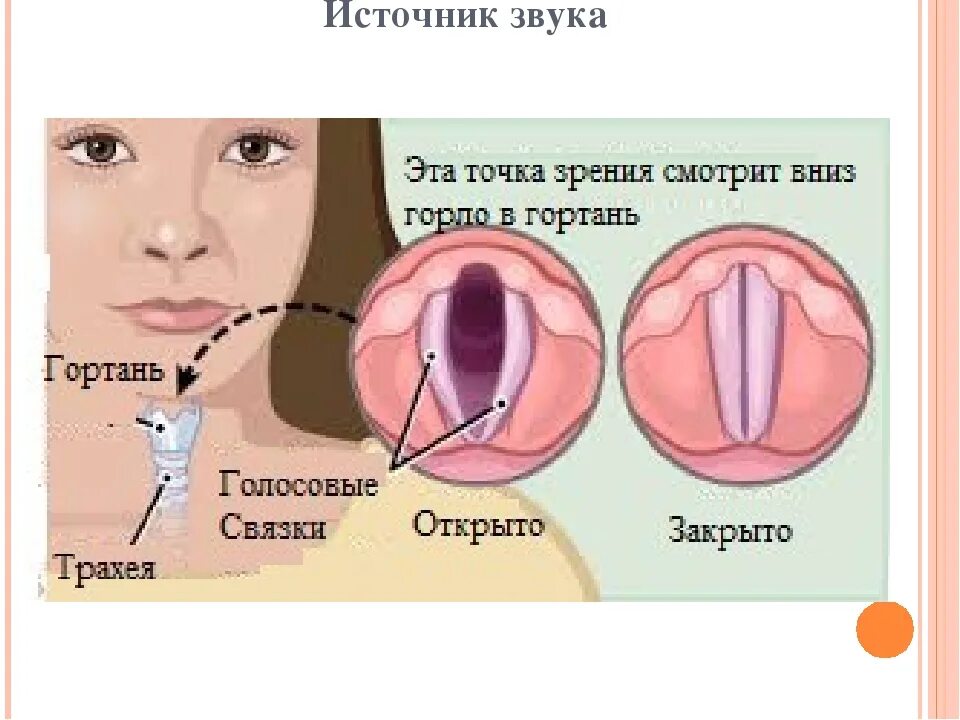 Лечение голосовых. Здоровые голосовые связки. Воспалённые голосовые связки. Сорванные голосовые связки. Голосовые связки у девушек.