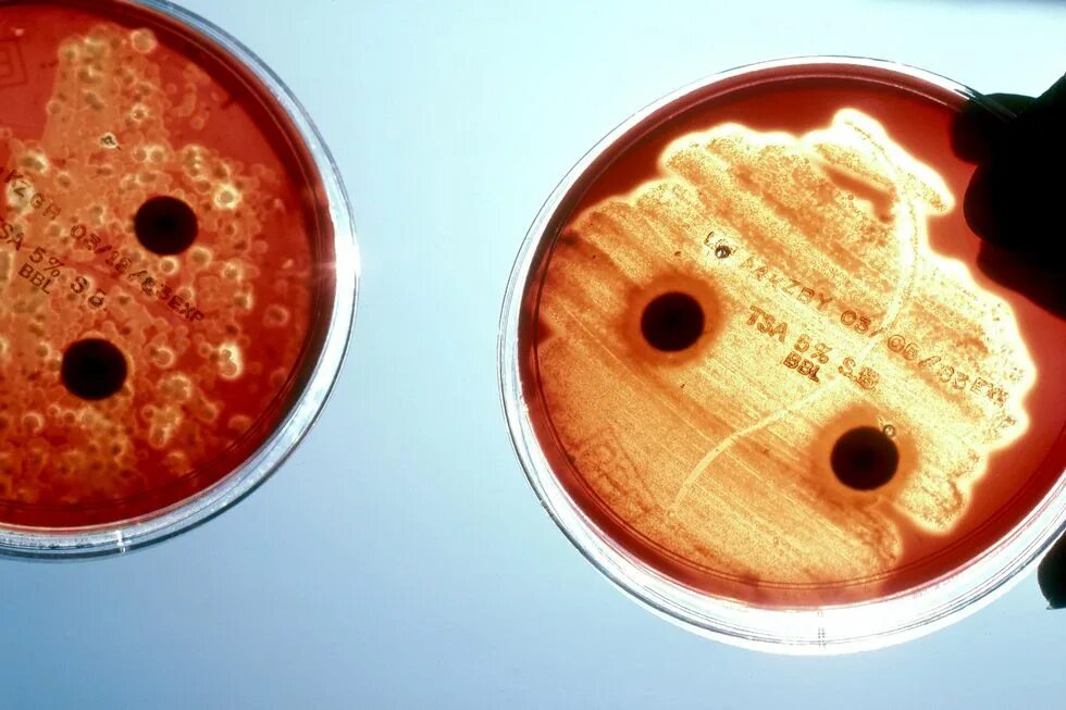 Streptococcus