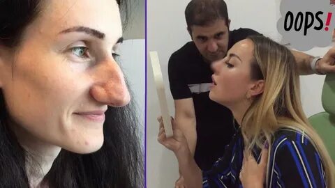 Сложный нос