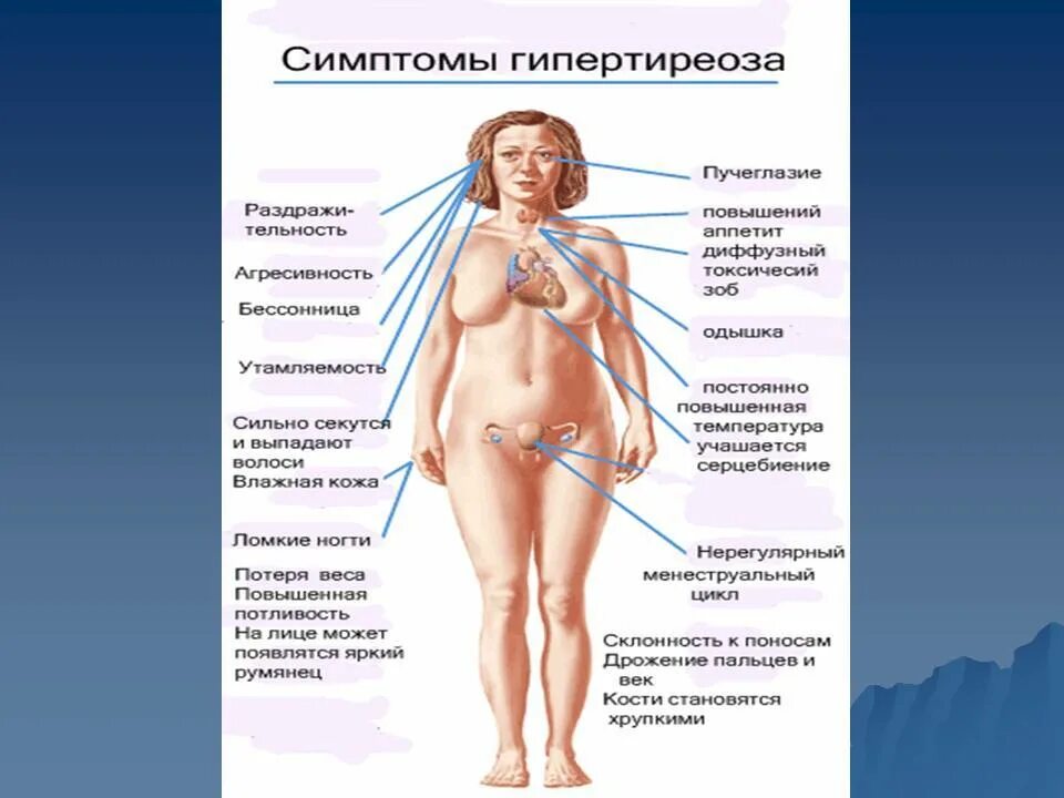 Больным с гипотиреозом. Половая система при гипертиреозе. Клинические проявления при гипотиреозе и гипертиреозе. Заболевания щитовидной железы (гипертиреоз, тиреотоксикоз)..