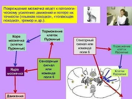 Повреждение мозжечка