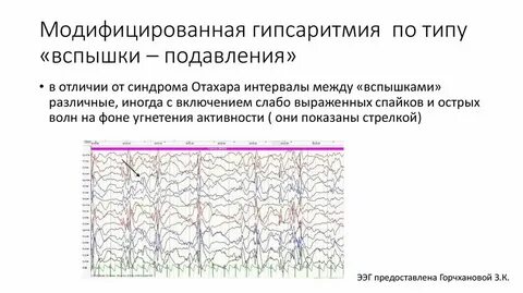 Синдром подавления мангалиб
