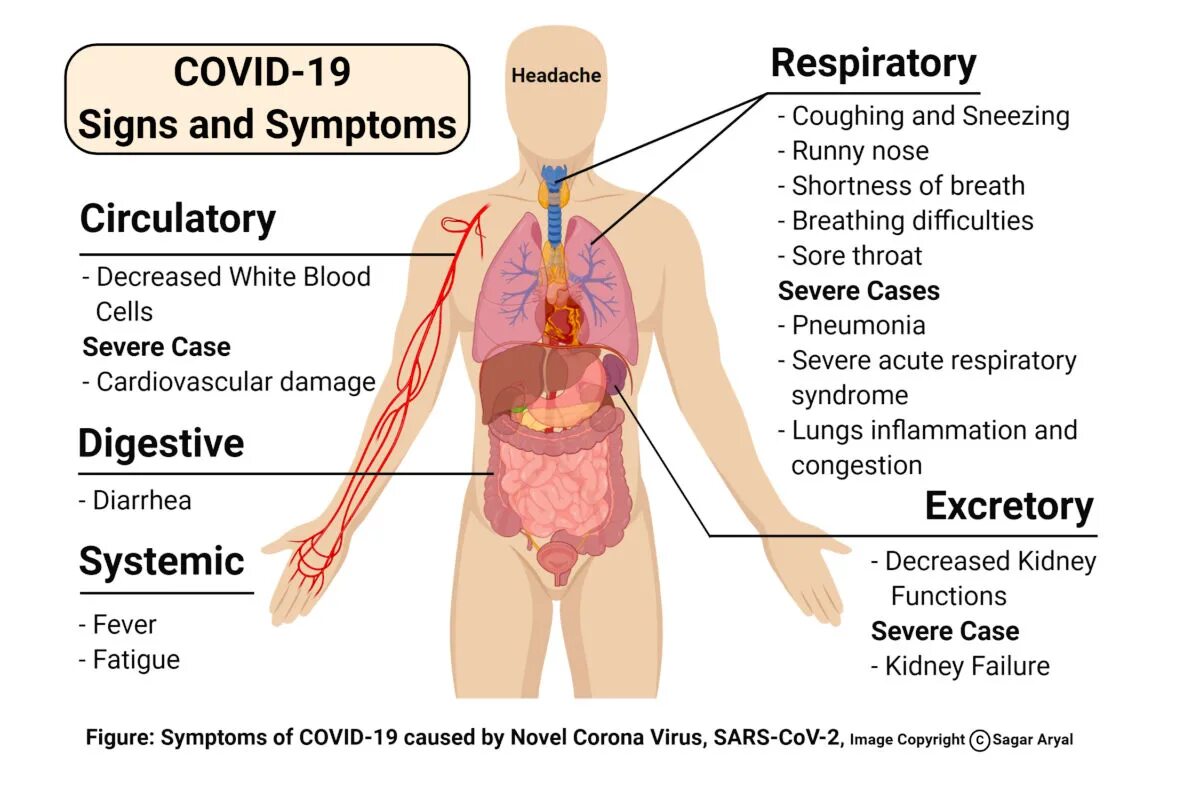 Коронавирус Covid. Covid 19 Symptoms. Symptom картинка. Англ. Coronavirus disease 2019).