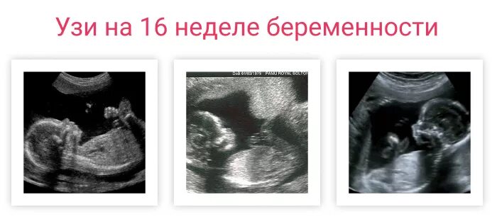 Плод на 16 неделе беременности УЗИ. Плод 16 недель беременности УЗИ плода. УЗИ 16 недель беременности фото. 16 недель 3 5